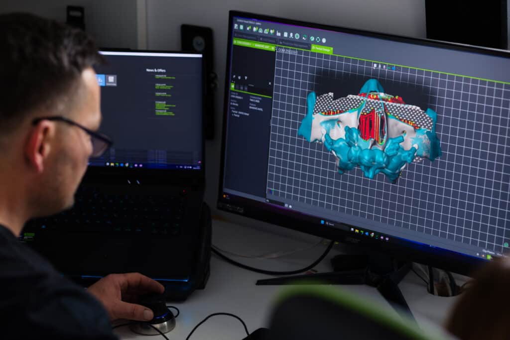 Virtualno oblikovanje vašeg novog osmijeha – CAD/CAM tehnologija omogućuje nam da na ekranu savršeno prilagodimo oblik i anatomiju zuba vašem licu.