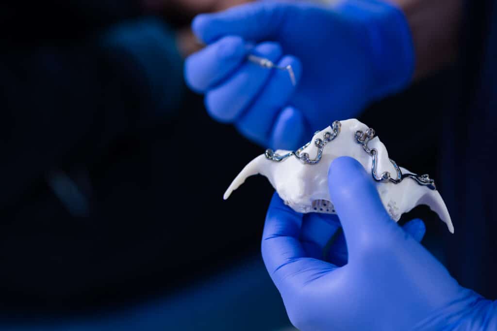 Revolucija za slučajeve s potpunim nedostatkom kosti: Individualni subperiostalni implantat od titana, izrađen pomoću 3D tehnologije točno prema anatomiji pacijenta, omogućuje fiksne zube i tamo gdje klasični implantati nisu mogući