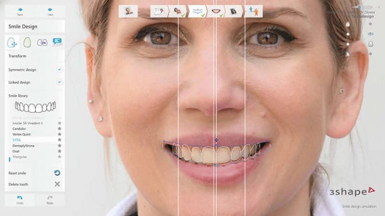 Digital Smile Design concept | Dental polyclinic Smile