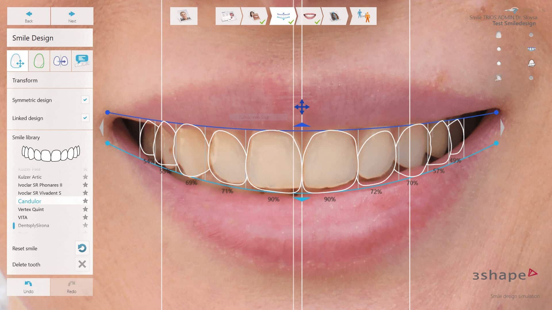 Smile Design - your new perfect smile | Poliklinika Smile Opatija