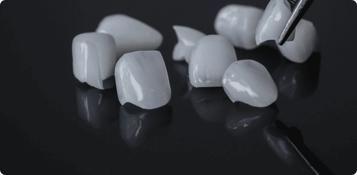 Keramičke zubne krunice za oralnu rehabilitaciju