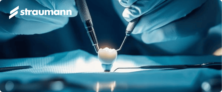 Impianto su modello – collaborazione con Straumann in implantologia